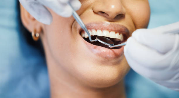 Urgent Tooth Repair in WI