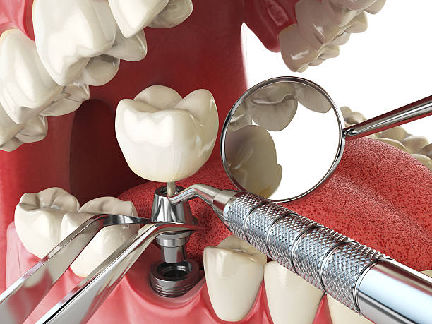 Dentist for Dental Trauma in WI